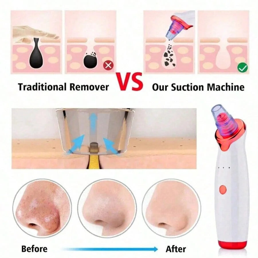 New Facial Blackhead Remover