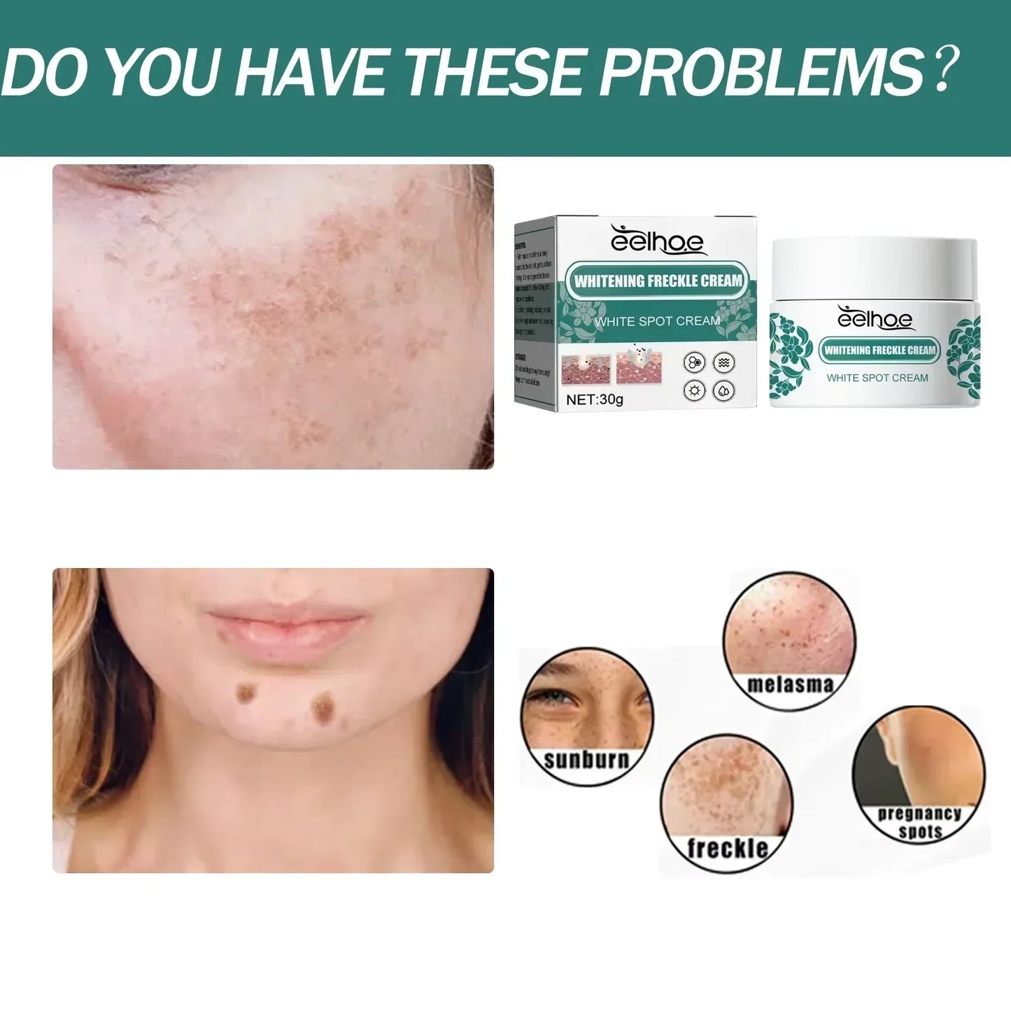 New Niacinamide Melasma Brightening Cream