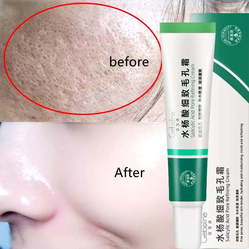 New Salicylic Acid Pore Shrinking Cream