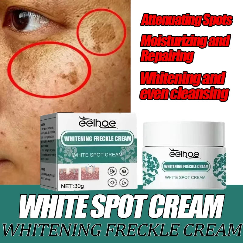 New Niacinamide Melasma Brightening Cream