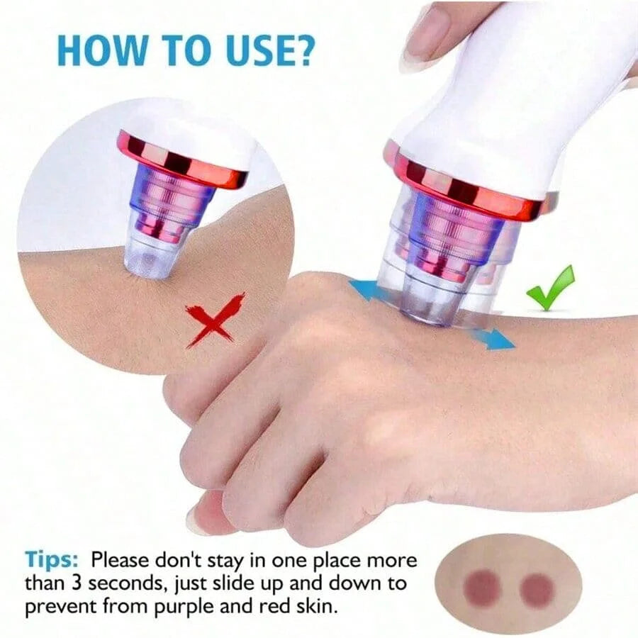 New Facial Blackhead Remover