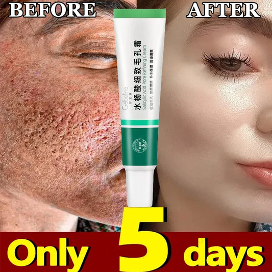 New Salicylic Acid Pore Shrinking Cream