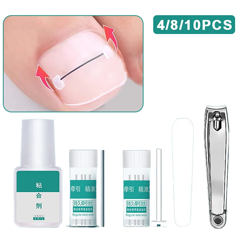Ingrown Toenail Corrector Tools