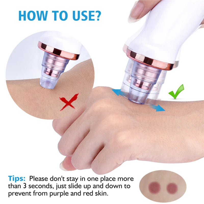 New Electric Facial Blackhead Remover