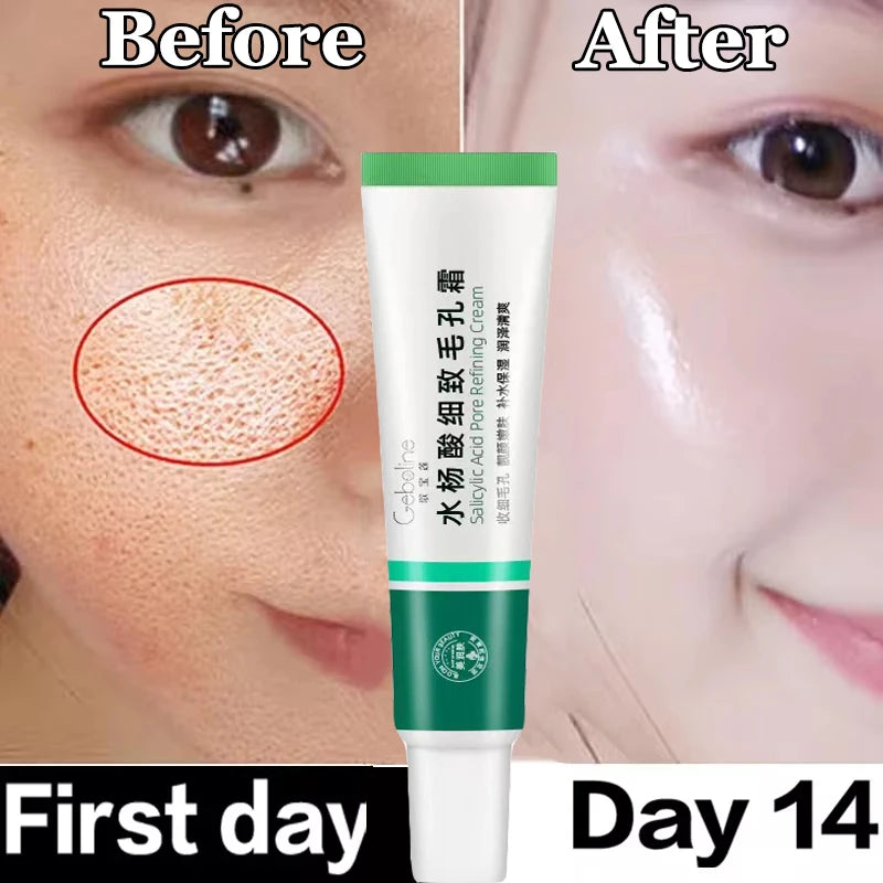 New Salicylic Acid Pore Shrinking Cream