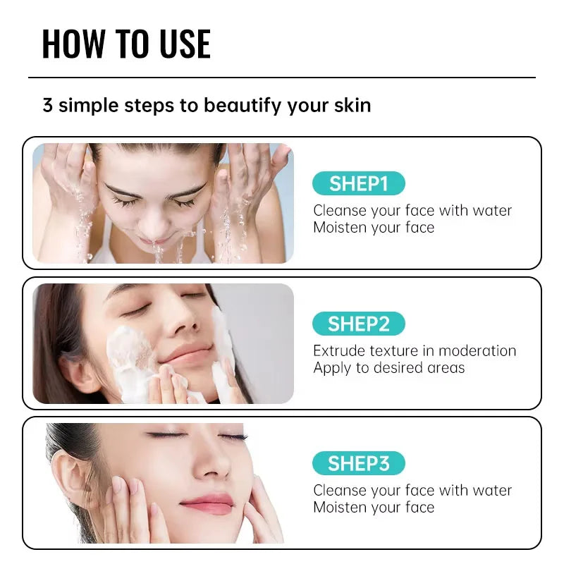 New Salicylic Acid Acne Treatment Cream