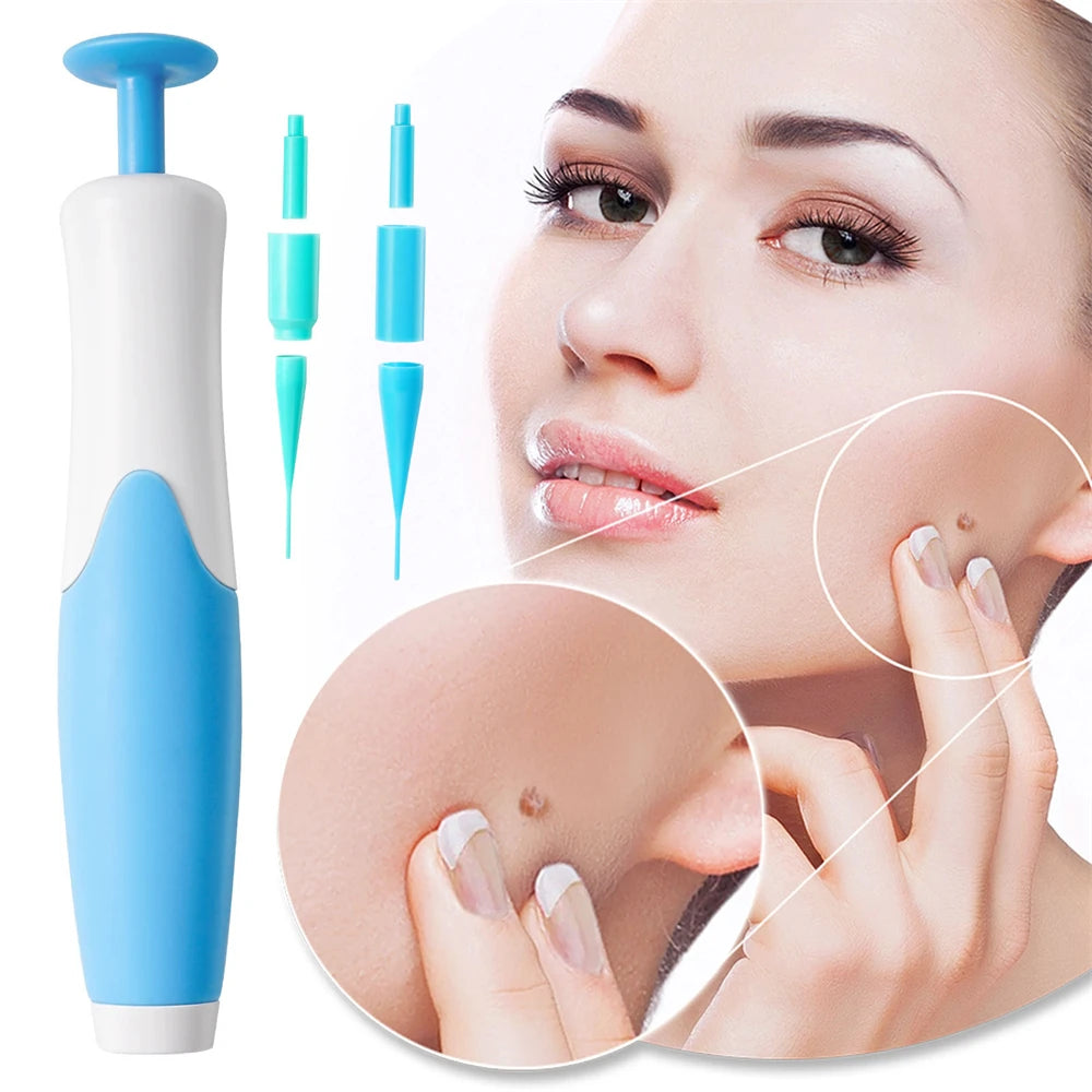 Body Wart Dot Treatments Remover