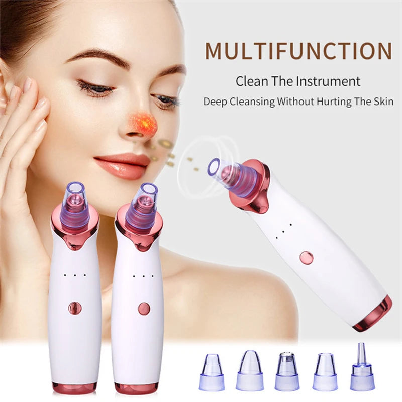 New Electric Facial Blackhead Remover