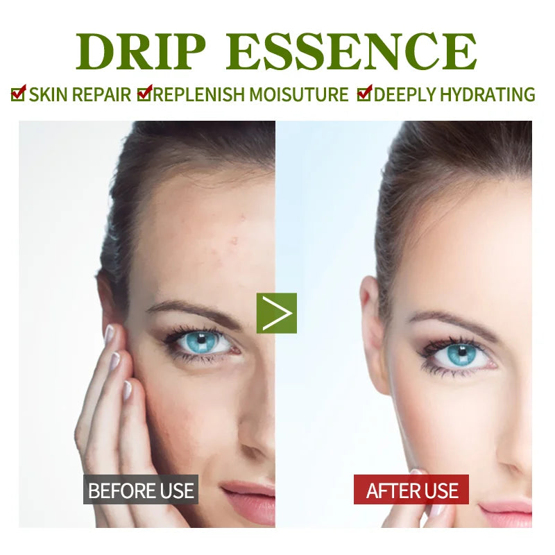 New Skin Aloe Soothe Pores Shrink Firming Hydrating Oil