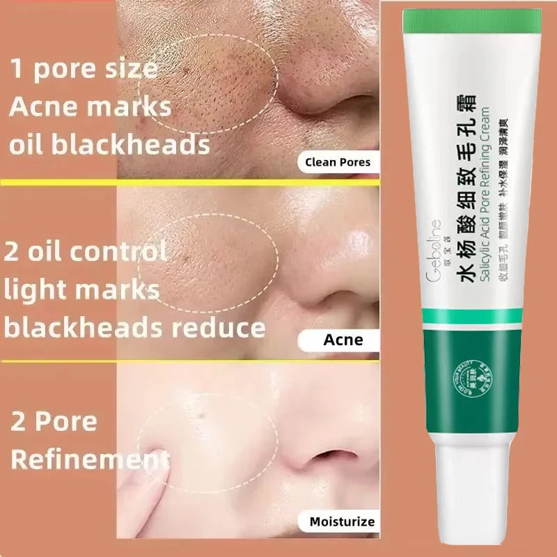 New Salicylic Acid Pore Shrinking Cream