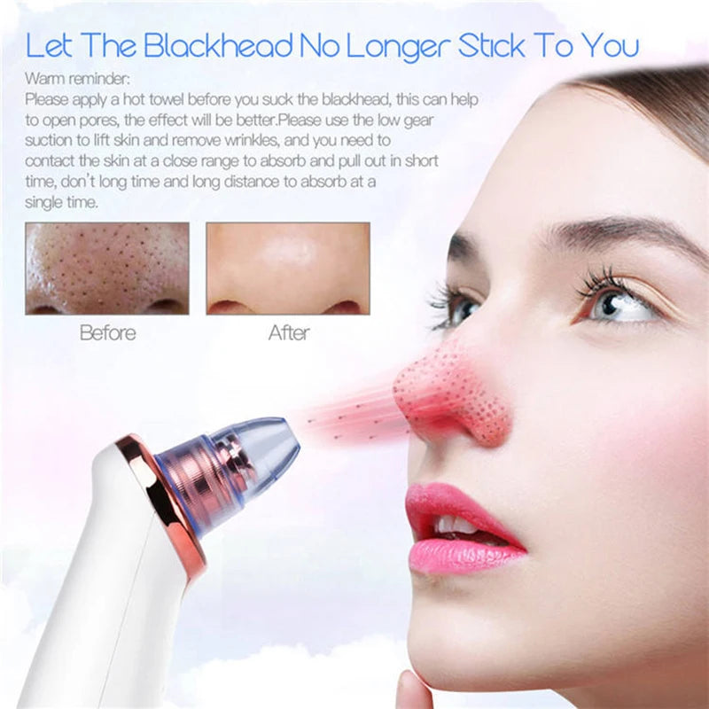 New Electric Facial Blackhead Remover
